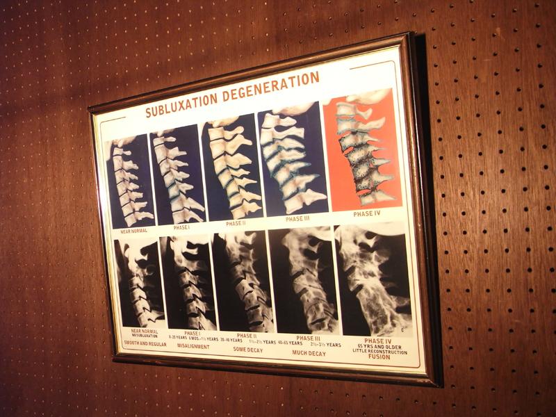 医療写真壁掛け、骨写真、メディカルアート LCP 0393(3)