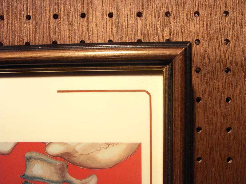 医療写真壁掛け、骨写真、メディカルアート LCP 0393(5)